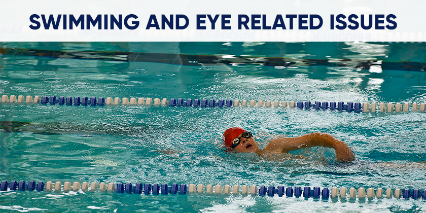 Swimming and eye related issues